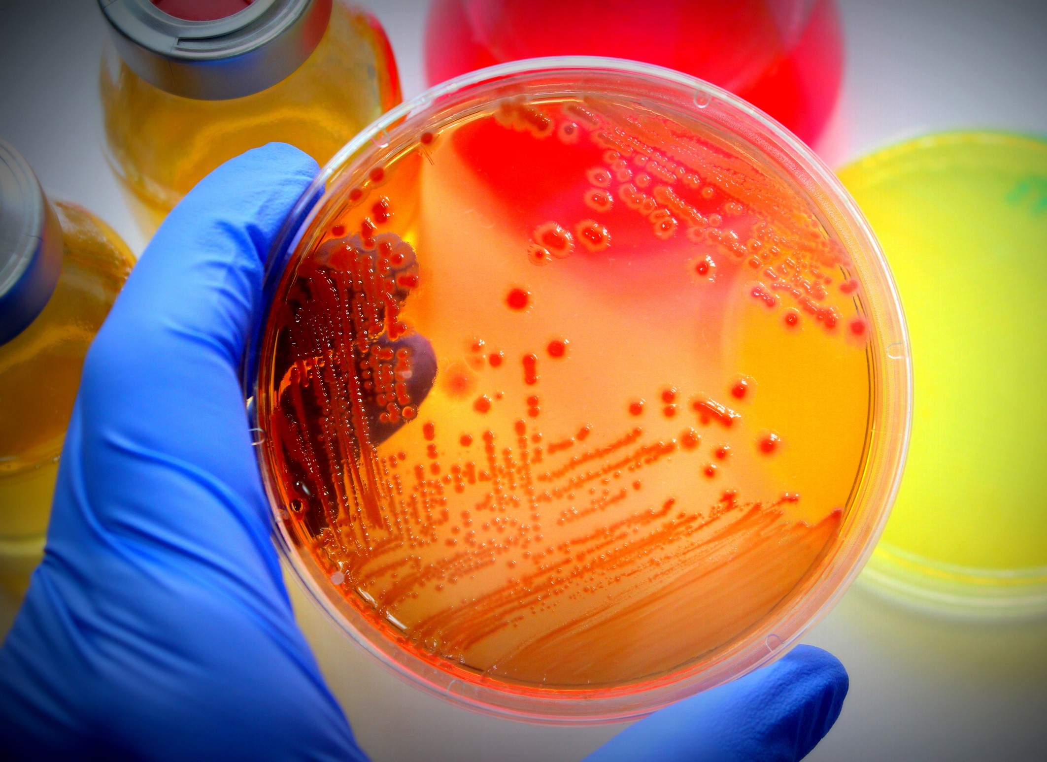 pertri dish
